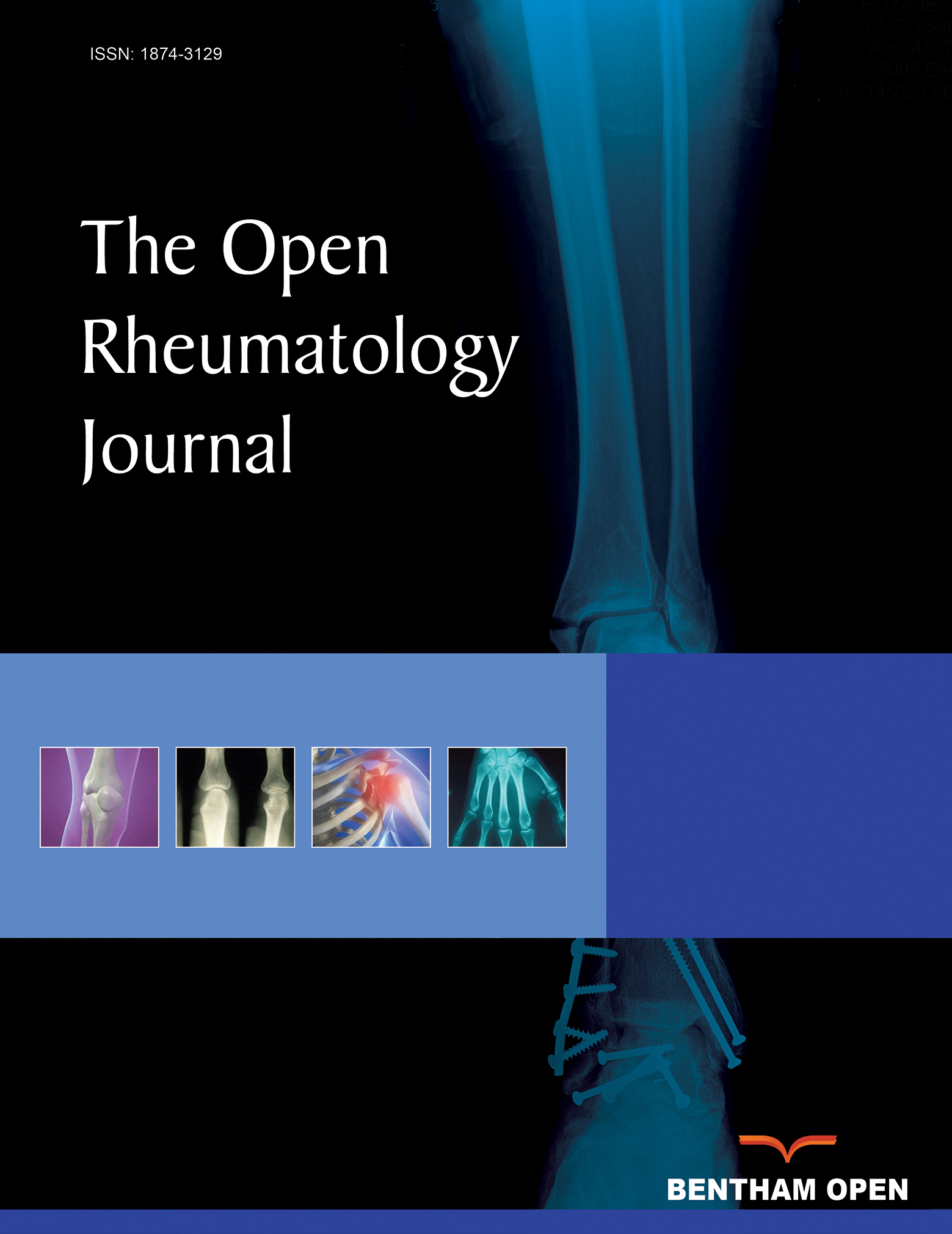 The Open Rheumatology Journal
